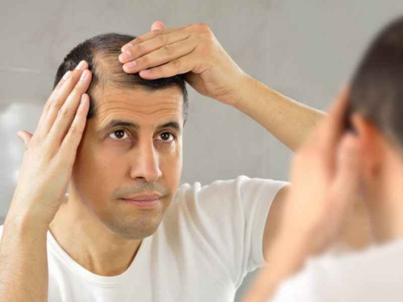 جلوگیری از ریزش مو ناشی از مصرف مکمل